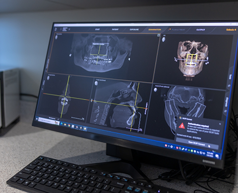 3 D models of jaw and skull on computer screen