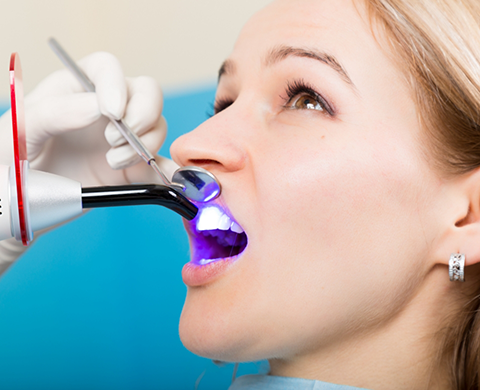 Woman receiving dental bonding on upper front tooth