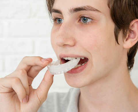 Person placing a white nightguard over their teeth