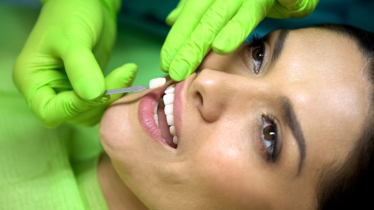 A porcelain veneer being attached to a woman's tooth